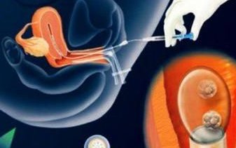 试管备孕之前如何调理身体？